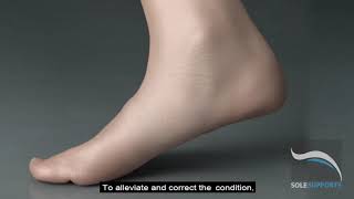 Tarsal Tunnel Syndrome [upl. by Attenborough]