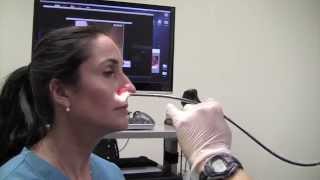 Esophagoscopy Without Sedation TransNasal Esophagoscopy Esophagus Exam Endoscopy [upl. by Jennifer]