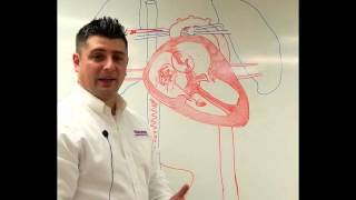 Neonatal Circulation Part 13 Preductal Sp02 [upl. by Ecnarepmet]