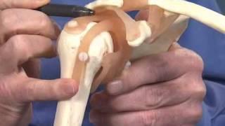 Shoulder Impingement  Dr Richard Hawkins [upl. by Assenov]